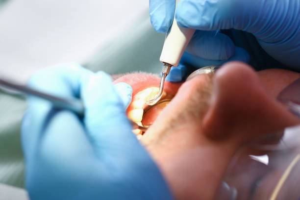 Best Emergency Dentist for Knocked-Out Tooth in Camp Point, IL