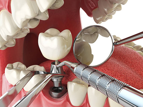 Best Emergency Cosmetic Dentistry in Camp Point, IL